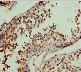 Immunohistochemistry of paraffin-embedded human testis tissue using CSB-PA848846DSR1HU at dilution of 1:100