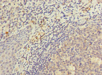 Immunohistochemistry of paraffin-embedded human tonsil tissue using CSB-PA850818ESR1HU at dilution of 1:100