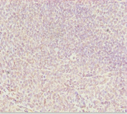 Immunohistochemistry of paraffin-embedded human tonsil tissue using CSB-PA853416ESR1HU at dilution of 1:100