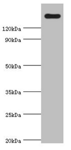 Western blot All lanes: CARD11 antibody at 4microg/ml + K562 whole cell lysate Secondary Goat polyclonal to rabbit IgG at 1/10000 dilution Predicted band size: 133 kDa Observed band size: 133 kDa