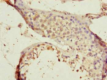 Immunohistochemistry of paraffin-embedded human testis tissue using CSB-PA889176DSR2HU at dilution of 1:100