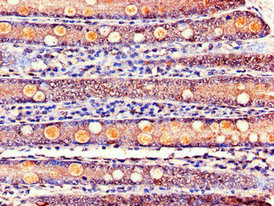 Immunohistochemistry of paraffin-embedded human small intestine tissue using CSB-PA012025LA01HU at dilution of 1:100