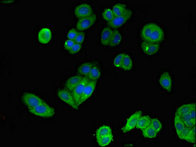 Immunofluorescent analysis of HepG2 cells using CSB-PA013413LA01HU at dilution of 1:100 and Alexa Fluor 488-congugated AffiniPure Goat Anti-Rabbit IgG(H+L)