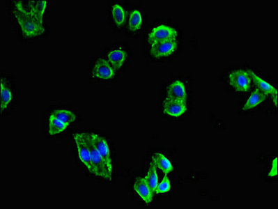 Immunofluorescent analysis of HepG2 cells using CSB-PA013449LA01HU at dilution of 1:100 and Alexa Fluor 488-congugated AffiniPure Goat Anti-Rabbit IgG(H+L)