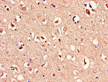 Immunohistochemistry of paraffin-embedded human brain tissue using CSB-PA013449LA01HU at dilution of 1:100