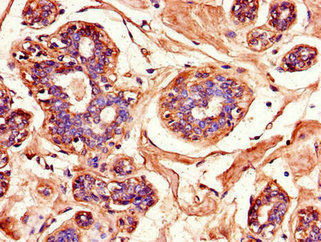 Immunohistochemistry of paraffin-embedded human testis tissue using CSB-PA013449LA01HU at dilution of 1:100