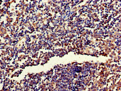 Immunohistochemistry of paraffin-embedded human tonsil tissue using CSB-PA020160LA01HU at dilution of 1:100