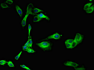 Immunofluorescent analysis of Hela cells using CSB-PA021189LA01HU at dilution of 1:100 and Alexa Fluor 488-congugated AffiniPure Goat Anti-Rabbit IgG(H+L)