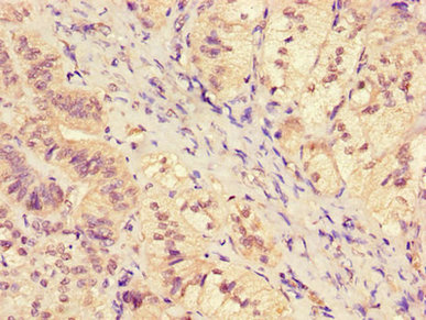 Immunohistochemistry of paraffin-embedded human adrenal gland tissue using CSB-PA021189LA01HU at dilution of 1:100