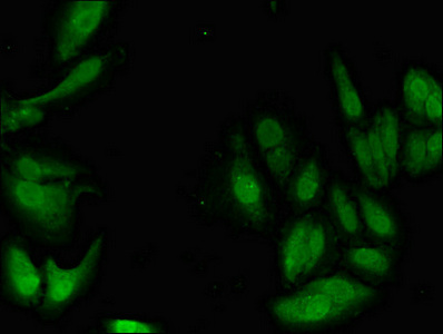 Immunofluorescent analysis of Hela cells using CSB-PA02959A0Rb at dilution of 1:100 and Alexa Fluor 488-congugated AffiniPure Goat Anti-Rabbit IgG(H+L)