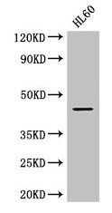 Western Blot Positive WB detected in: HL60 whole cell lysate All lanes: MAP2K2 antibody at 2.8microg/ml Secondary Goat polyclonal to rabbit IgG at 1/50000 dilution Predicted band size: 45 kDa Observed band size: 45 kDa