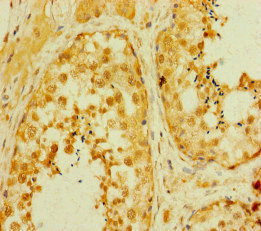 Immunohistochemistry of paraffin-embedded human testis tissue using CSB-PA15557A0Rb at dilution of 1:100