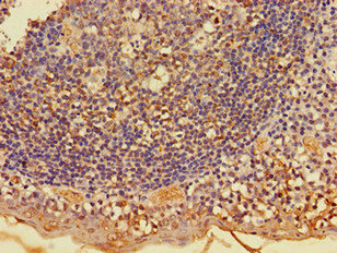 Immunohistochemistry of paraffin-embedded human tonsil tissue using CSB-PA617913LA01HU at dilution of 1:100