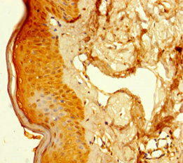 Immunohistochemistry of paraffin-embedded human skin tissue using CSB-PA835618LA01HU at dilution of 1:100