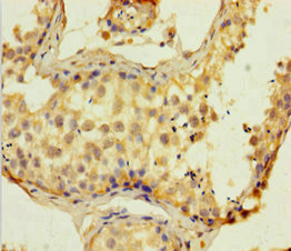 Immunohistochemistry of paraffin-embedded human testis tissue using CSB-PA835618LA01HU at dilution of 1:100