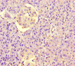 Immunohistochemistry of paraffin-embedded human pancreatic tissue using CSB-PA836247LA01HU at dilution of 1:100