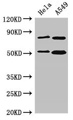 Western Blot Positive WB detected in: Hela whole cell lysate, A549 whole cell lysate All lanes: SNX27 antibody at 3.5microg/ml Secondary Goat polyclonal to rabbit IgG at 1/50000 dilution Predicted band size: 62, 60, 51 kDa Observed band size: 51 kDa