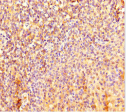 Immunohistochemistry of paraffin-embedded human tonsil tissue using CSB-PA850426LA01HU at dilution of 1:100