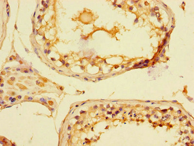 Immunohistochemistry of paraffin-embedded human testis tissue using CSB-PA873725LA01HU at dilution of 1:100