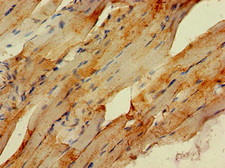 Immunohistochemistry of paraffin-embedded human skeletal muscle tissue using CSB-PA892480LA01HU at dilution of 1:100