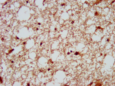 IHC image of CSB-PA007192LA01HU diluted at 1:200 and staining in paraffin-embedded human brain tissue performed on a Leica BondTM system. After dewaxing and hydration, antigen retrieval was mediated by high pressure in a citrate buffer (pH 6.0). Section was blocked with 10% normal goat serum 30min at RT. Then primary antibody (1% BSA) was incubated at 4°C overnight. The primary is detected by a biotinylated secondary antibody and visualized using an HRP conjugated SP system.