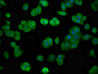 Immunofluorescence staining of HepG2 cells with CSB-PA008648LA01HU at 1:100, counter-stained with DAPI. The cells were fixed in 4% formaldehyde, permeabilized using 0.2% Triton X-100 and blocked in 10% normal Goat Serum. The cells were then incubated with the antibody overnight at 4°C. The secondary antibody was Alexa Fluor 488-congugated AffiniPure Goat Anti-Rabbit IgG(H+L).