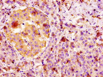 IHC image of CSB-PA008648LA01HU diluted at 1:100 and staining in paraffin-embedded human pancreatic tissue performed on a Leica BondTM system. After dewaxing and hydration, antigen retrieval was mediated by high pressure in a citrate buffer (pH 6.0). Section was blocked with 10% normal goat serum 30min at RT. Then primary antibody (1% BSA) was incubated at 4°C overnight. The primary is detected by a biotinylated secondary antibody and visualized using an HRP conjugated SP system.