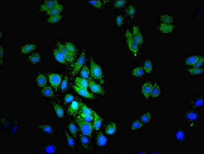 Immunofluorescent analysis of HepG2 cells using CSB-PA012972EA01HU at dilution of 1:100 and Alexa Fluor 489-congugated AffiniPure Goat Anti-Rabbit IgG(H+L)