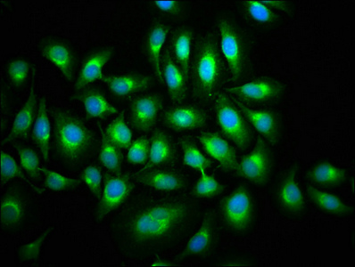 Immunofluorescence staining of A549 cells with CSB-PA013434LA01HU at 1:133, counter-stained with DAPI. The cells were fixed in 4% formaldehyde, permeabilized using 0.2% Triton X-100 and blocked in 10% normal Goat Serum. The cells were then incubated with the antibody overnight at 4°C. The secondary antibody was Alexa Fluor 488-congugated AffiniPure Goat Anti-Rabbit IgG(H+L).