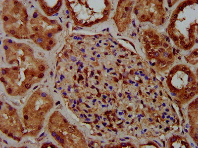 IHC image of CSB-PA617899LA01HU diluted at 1:400 and staining in paraffin-embedded human kidney tissue performed on a Leica BondTM system. After dewaxing and hydration, antigen retrieval was mediated by high pressure in a citrate buffer (pH 6.0). Section was blocked with 10% normal goat serum 30min at RT. Then primary antibody (1% BSA) was incubated at 4°C overnight. The primary is detected by a biotinylated secondary antibody and visualized using an HRP conjugated SP system.