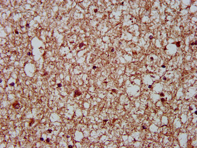 IHC image of CSB-PA617899LA01HU diluted at 1:400 and staining in paraffin-embedded human brain tissue performed on a Leica BondTM system. After dewaxing and hydration, antigen retrieval was mediated by high pressure in a citrate buffer (pH 6.0). Section was blocked with 10% normal goat serum 30min at RT. Then primary antibody (1% BSA) was incubated at 4°C overnight. The primary is detected by a biotinylated secondary antibody and visualized using an HRP conjugated SP system.