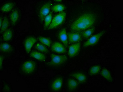 anti-Homo sapiens (Human) RNF213 Antibody raised in Rabbit - Cusabio