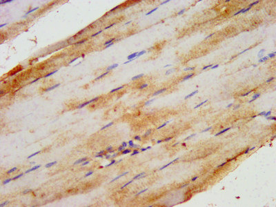 IHC image of CSB-PA803159LA01HU diluted at 1:200 and staining in paraffin-embedded human skeletal muscle tissue performed on a Leica BondTM system. After dewaxing and hydration, antigen retrieval was mediated by high pressure in a citrate buffer (pH 6.0). Section was blocked with 10% normal goat serum 30min at RT. Then primary antibody (1% BSA) was incubated at 4°C overnight. The primary is detected by a biotinylated secondary antibody and visualized using an HRP conjugated SP system.