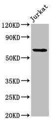 Western Blot Positive WB detected in: Jurkat whole cell lysate All lanes: SLAIN1 antibody at 4.2microg/ml Secondary Goat polyclonal to rabbit IgG at 1/50000 dilution Predicted band size: 61, 34, 21, 48 kDa Observed band size: 61 kDa