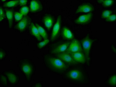 Immunofluorescence staining of A549 cells with CSB-PA873704LA01HU at 1:100, counter-stained with DAPI. The cells were fixed in 4% formaldehyde, permeabilized using 0.2% Triton X-100 and blocked in 10% normal Goat Serum. The cells were then incubated with the antibody overnight at 4°C. The secondary antibody was Alexa Fluor 488-congugated AffiniPure Goat Anti-Rabbit IgG(H+L).