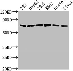 Western Blot Positive WB detected in: 293 whole cell lysate, HepG2 whole cell lysate, 293T whole cell lysate, K562 whole cell lysate, Mouse brain tissue, Mouse liver tissue All lanes: HSPD1 antibody at 1:2000 Secondary Goat polyclonal to rabbit IgG at 1/50000 dilution Predicted band size: 62, 18 kDa Observed band size: 62 kDa