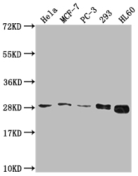 Western Blot Positive WB detected in: Hela whole cell lysate, MCF-7 whole cell lysate, PC-3 whole cell lysate, 293 whole cell lysate, HL60 whole cell lysate All lanes: RPL19 antibody at 1:2000 Secondary Goat polyclonal to rabbit IgG at 1/50000 dilution Predicted band size: 24 kDa Observed band size: 28 kDa