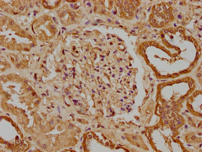 IHC image of CSB-PA025622LA01HU diluted at 1:300 and staining in paraffin-embedded human kidney tissue performed on a Leica BondTM system. After dewaxing and hydration, antigen retrieval was mediated by high pressure in a citrate buffer (pH 6.0). Section was blocked with 10% normal goat serum 30min at RT. Then primary antibody (1% BSA) was incubated at 4°C overnight. The primary is detected by a biotinylated secondary antibody and visualized using an HRP conjugated SP system.