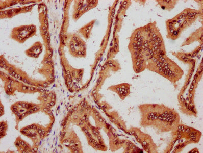 IHC image of CSB-PA15557A0Rb diluted at 1:600 and staining in paraffin-embedded human prostate tissue performed on a Leica BondTM system. After dewaxing and hydration, antigen retrieval was mediated by high pressure in a citrate buffer (pH 6.0). Section was blocked with 10% normal goat serum 30min at RT. Then primary antibody (1% BSA) was incubated at 4°C overnight. The primary is detected by a biotinylated secondary antibody and visualized using an HRP conjugated SP system.