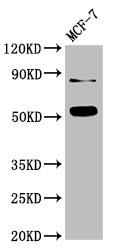 Western Blot Positive WB detected in: MCF-7 whole cell lysate All lanes: SMAD2 antibody at 3ug/ml Secondary Goat polyclonal to rabbit IgG at 1/50000 dilution Predicted band size: 53, 49 kDa Observed band size: 53 kDa