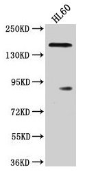 Western Blot Positive WB detected in: HL60 whole cell lysate All lanes: ROCK1 antibody at 1:2000 Secondary Goat polyclonal to rabbit IgG at 1/50000 dilution Predicted band size: 159 kDa Observed band size: 159 kDa