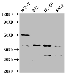 Western Blot Positive WB detected in: MCF-7 whole cell lysate, 293 whole cell lysate, HL60 whole cell lysate, K562 whole cell lysate All lanes: MRGPRX2 antibody at 1:2000 Secondary Goat polyclonal to rabbit IgG at 1/50000 dilution Predicted band size: 38 kDa Observed band size: 38 kDa