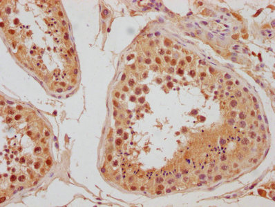 IHC image of CSB-PA845150NA01HU diluted at 1:300 and staining in paraffin-embedded human testis tissue performed on a Leica BondTM system. After dewaxing and hydration, antigen retrieval was mediated by high pressure in a citrate buffer (pH 6.0). Section was blocked with 10% normal goat serum 30min at RT. Then primary antibody (1% BSA) was incubated at 4°C overnight. The primary is detected by a biotinylated secondary antibody and visualized using an HRP conjugated SP system.