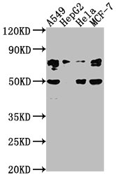 Western Blot Positive WB detected in: A549 whole cell lysate, HepG2 whole cell lysate, Hela whole cell lysate, MCF-7 whole cell lysate All lanes: LEO1 antibody at 1:2000 Secondary Goat polyclonal to rabbit IgG at 1/50000 dilution Predicted band size: 76, 69 kDa Observed band size: 76 kDa