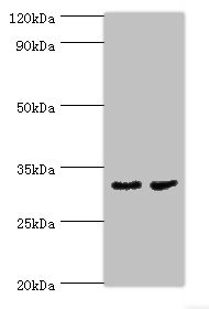 Western blot All lanes: CA8 antibody at 4ug/ml Lane 1: Mouse skeletal muscle tissue Lane 2: Mouse liver tissue Secondary Goat polyclonal to rabbit IgG at 1/10000 dilution Predicted band size: 33 kDa Observed band size 33 kDa