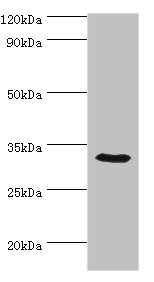 Western blot All lanes: CA8 antibody at 8ug/ml + Mouse liver tissue Secondary Goat polyclonal to rabbit IgG at 1/10000 dilution Predicted band size: 33 kDa Observed band size: 33 kDa