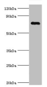 Western blot All lanes: Cartilage oligomeric matrix protein antibody at 4ug/ml + Mouse skeletal muscle tissue Secondary Goat polyclonal to rabbit IgG at 1/10000 dilution Predicted band size: 83, 78 kDa Observed band size: 83 kDa