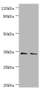 Western blot All lanes: Killer cell immunoglobulin-like receptor 2DS4 antibody at 4ug/ml Lane 1: K562 whole cell lysate Lane 2: Jurkat whole cell lysate Secondary Goat polyclonal to rabbit IgG at 1/10000 dilution Predicted band size: 34 kDa Observed band size: 34 kDa