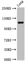 Western Blot Positive WB detected in: Rat lung tissue All lanes: MAP3K9 antibody at 2.7ug/ml Secondary Goat polyclonal to rabbit IgG at 1/50000 dilution Predicted band size: 122, 124 kDa Observed band size: 122 kDa