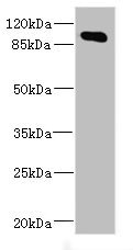 Western blot All lanes: MAP4K5 antibody at 4.2ug/ml + Mouse brain tissue Secondary Goat polyclonal to rabbit IgG at 1/10000 dilution Predicted band size: 95 kDa Observed band size: 95 kDa